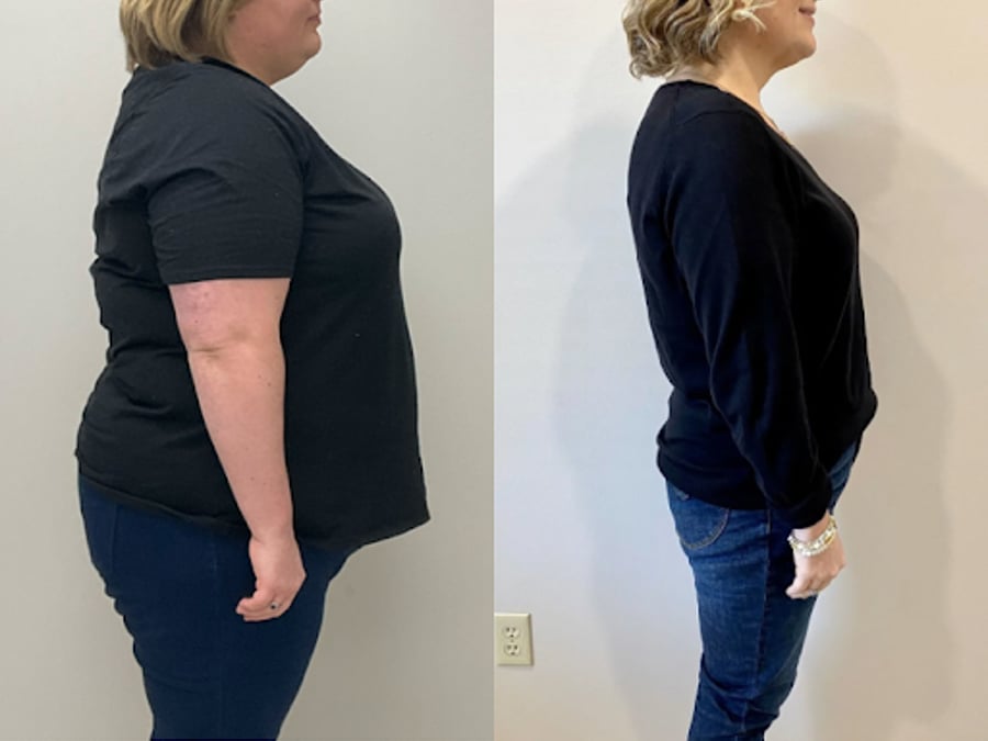 Merit Weight Loss