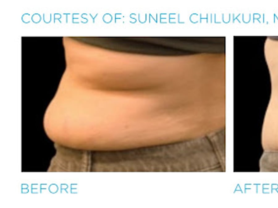 Zormeier Cosmetic Surgery and Longevity Center