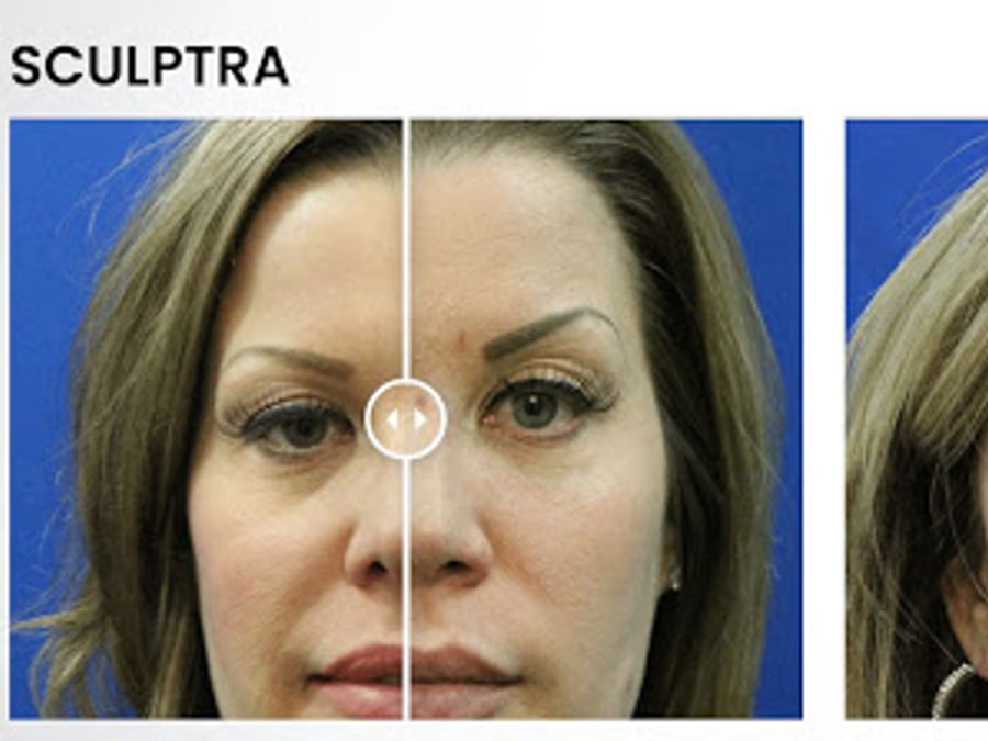 Advanced Regenerative Therapy