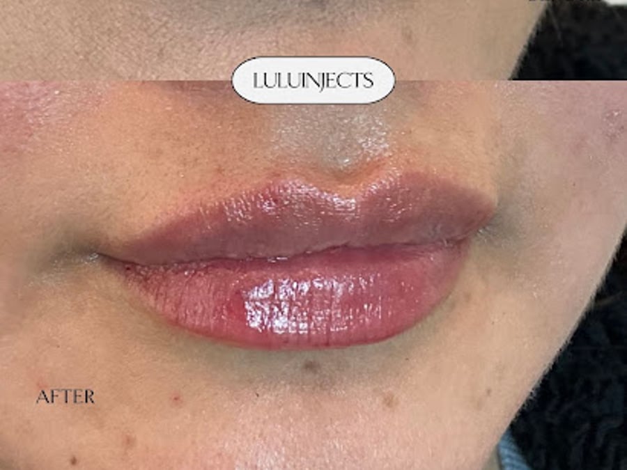 Lulu Ortiz MSN, FNP | Aluma Medical Aesthetics