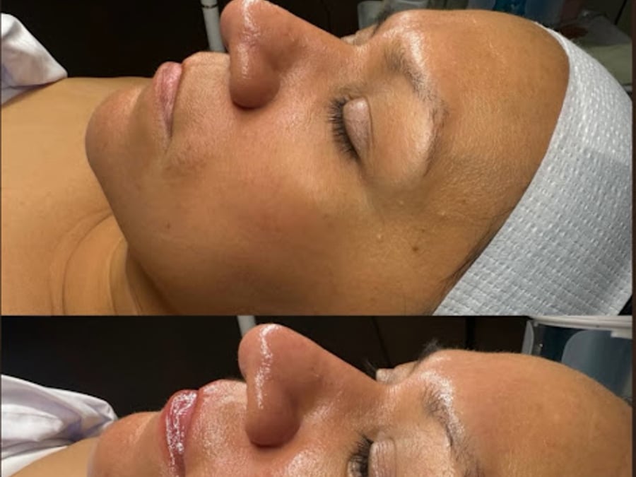 Raw Aesthetic Medical Spa by Sally Aziz