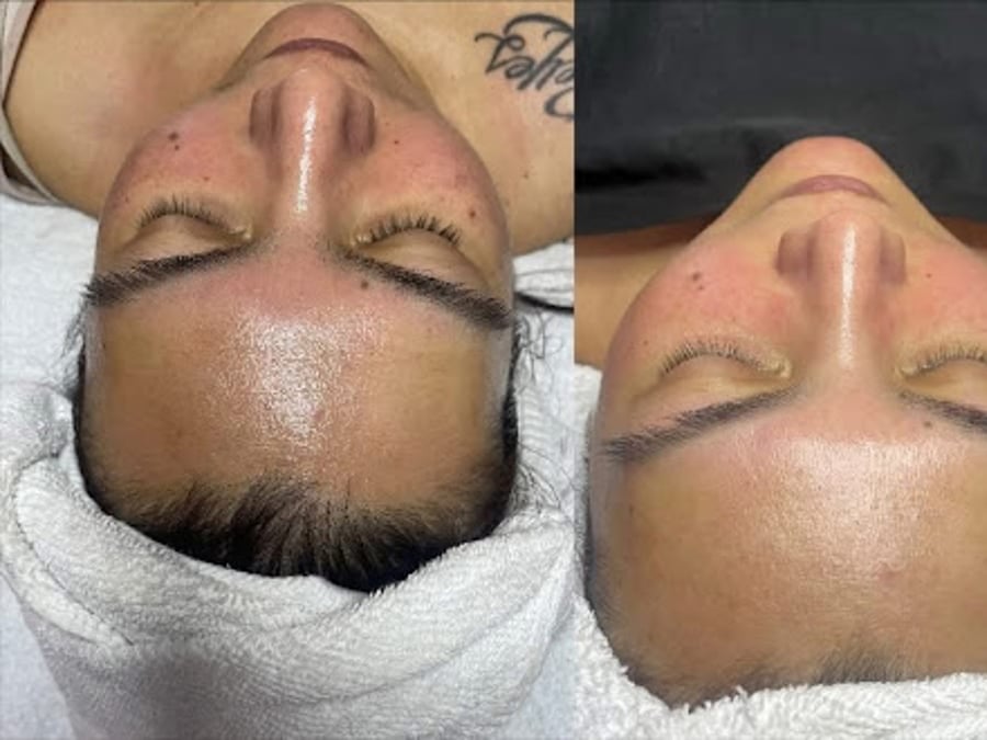 Honey Glow Aesthetics KC