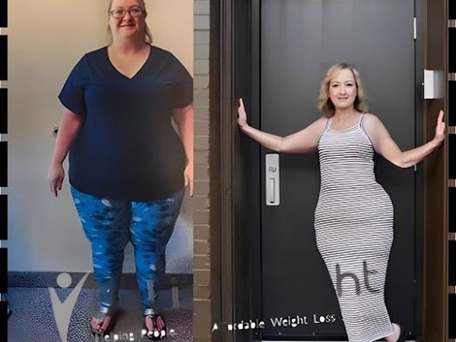 BeLiteWeight : Weight Loss Surgery in California, Gastric Sleeve, Gastric Bypass, Revision Weight Loss Surgery In Texas, USA