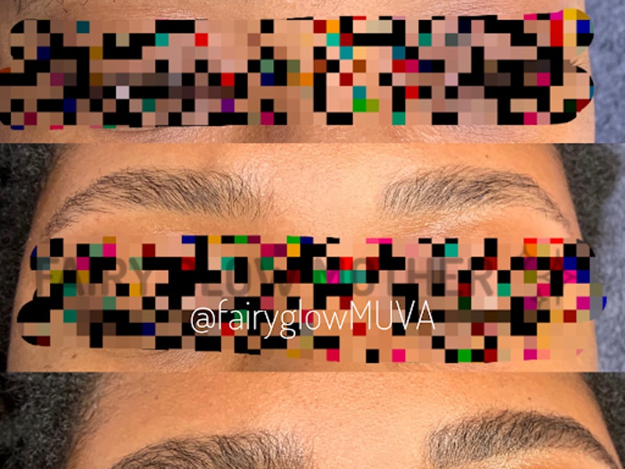 GLOWDEGA | Oakland Acne Experts & Brazilian Sugaring