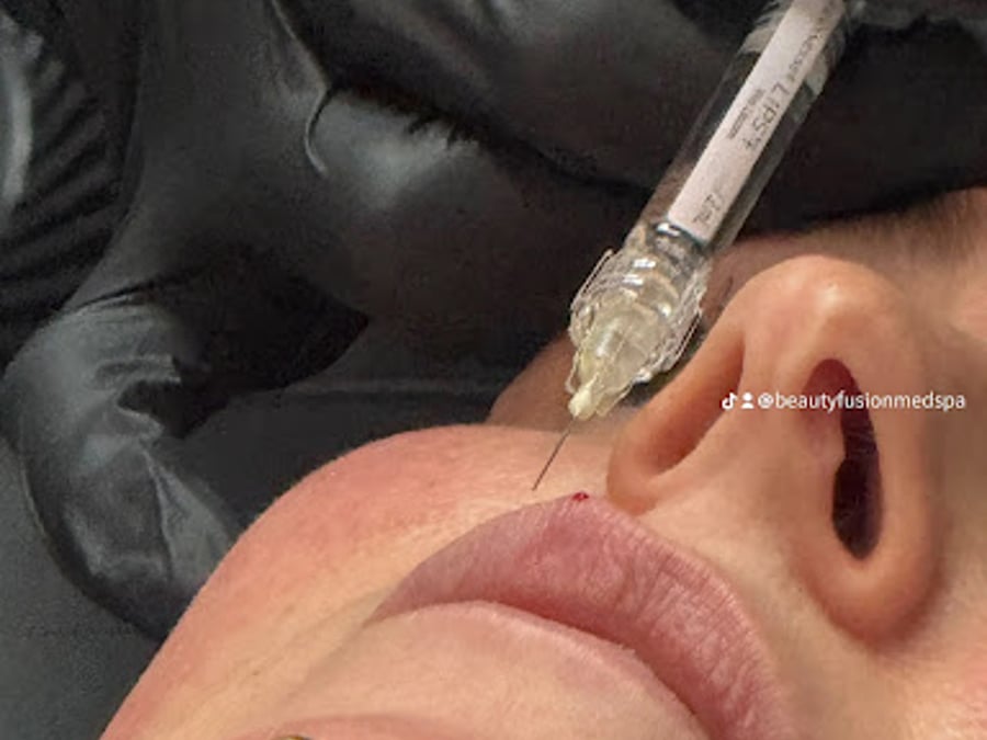 Beauty Fusion Med Spa